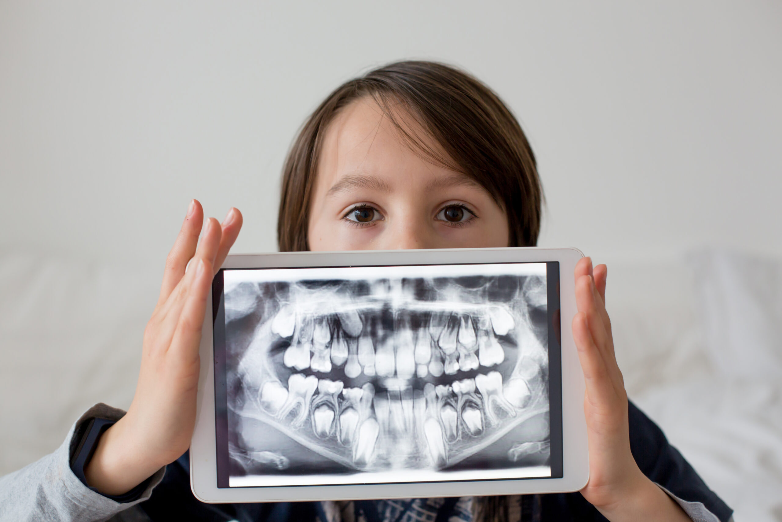 Are Digital Dental X-Rays Safe for My Child?